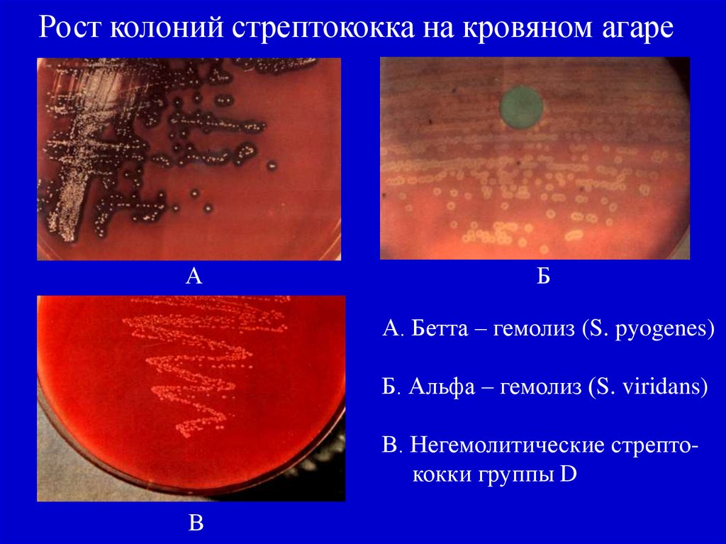 Альфа гемолиз. Альфа гемолиз на кровяном агаре. Гамма-гемолитические стрептококки на кровяном агаре. Колонии с зоной гемолиза на кровяном агаре.