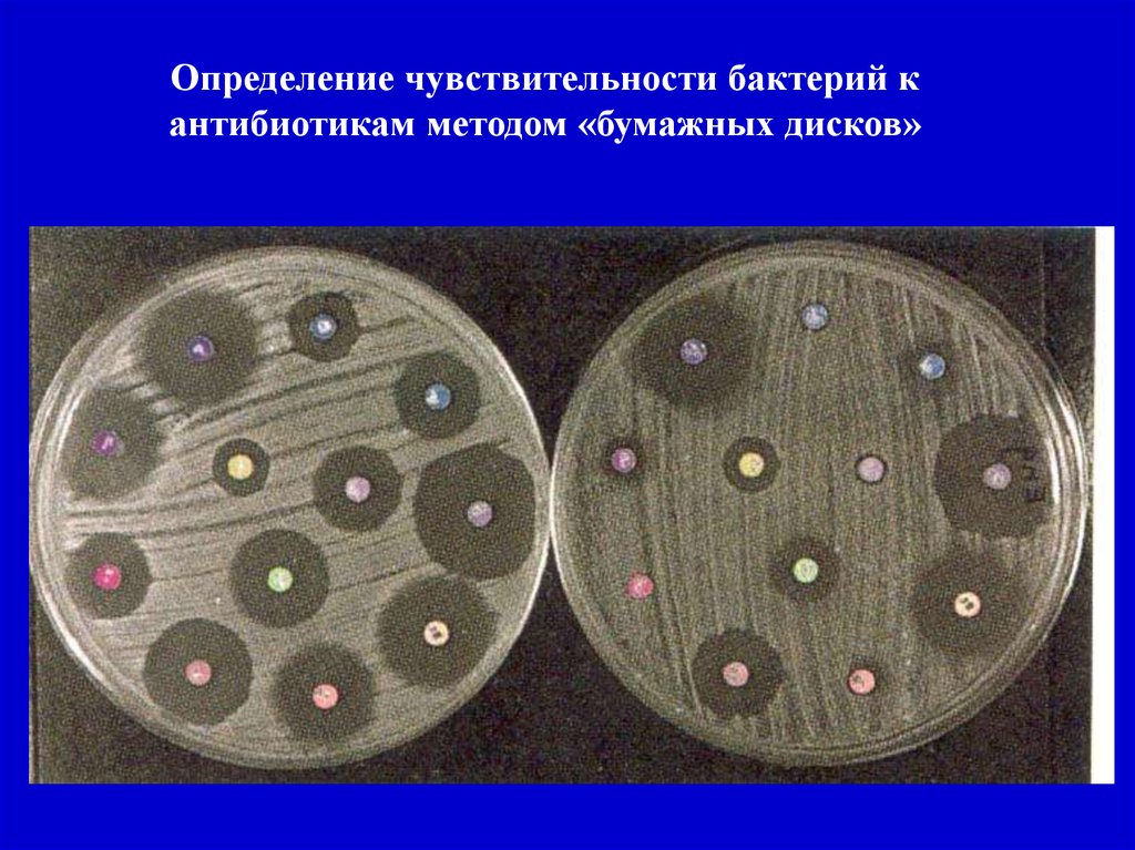 Определение чувствительности. Чувствительность к антибиотикам определяется методом. Методы чувствительности бактерий к антибиотикам. Методы оценки чувствительности бактерий к антибиотикам. Чувствительность бактерий к антибиотикам определяют методом.