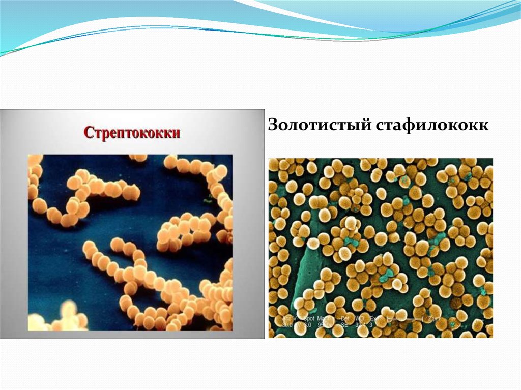 Staphylococcus aureus золотистый стафилококк