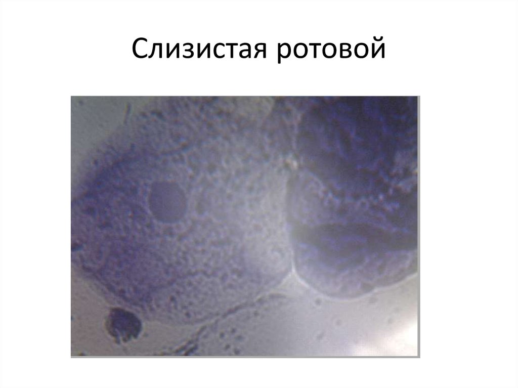 Слизистая ротовой