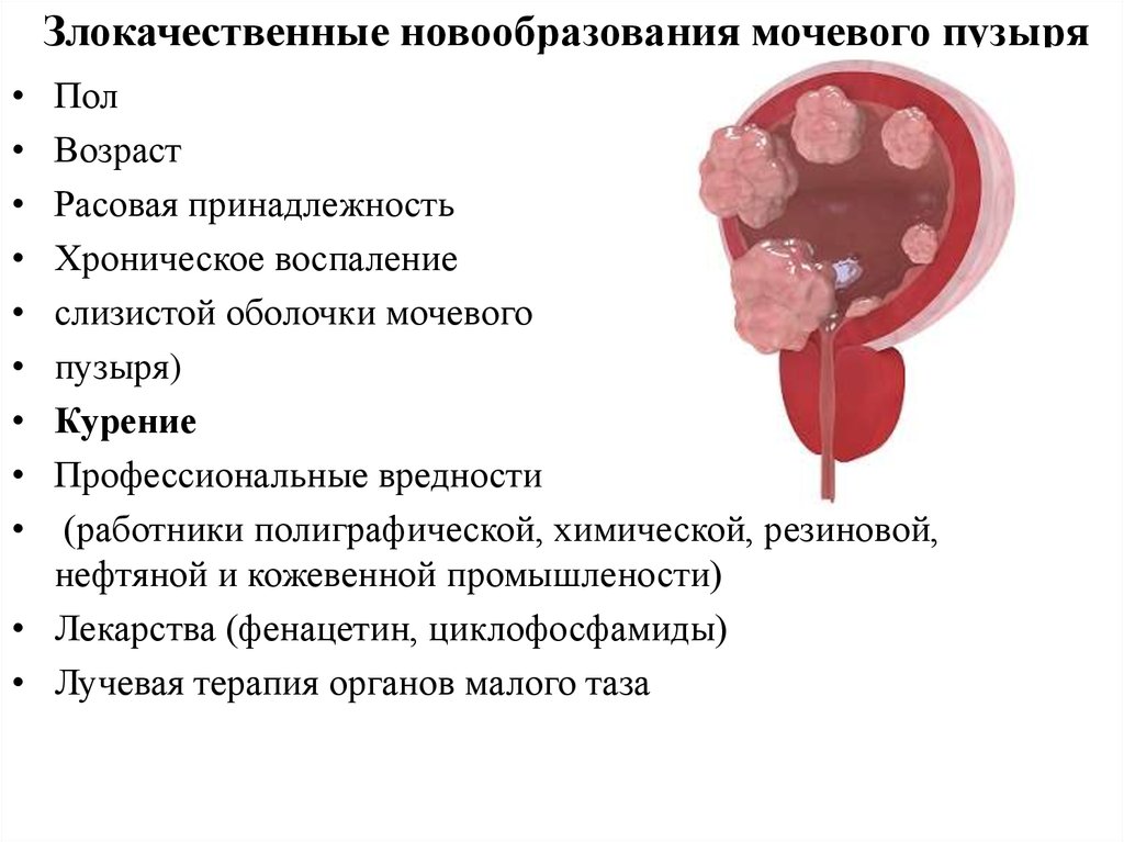 Размер раковой опухоли