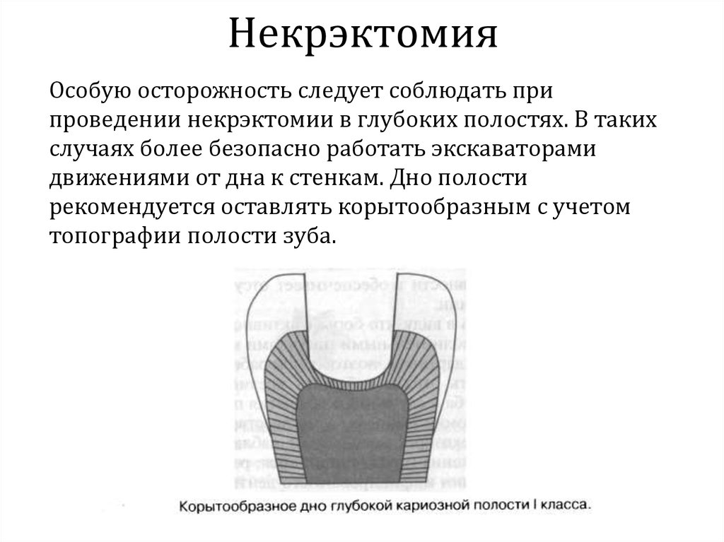 Полость применение. Некротомия и некрэктомия. Некрэктомия обезболивание. Некрэктомия кариозной полости. Некрэктомия 1 класса полостей по Блэку.