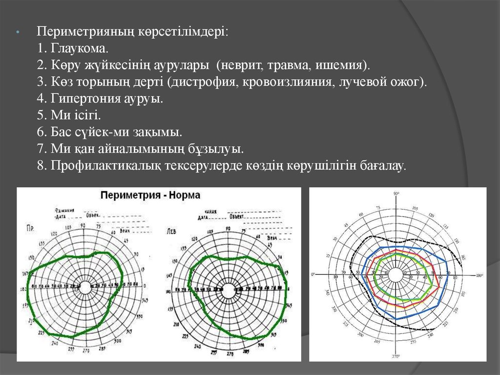 Кинетическая периметрия. Периметрия при вторичной глаукоме. Компьютерная периметрия норма. Периметрия при неврите. Статическая периметрия.