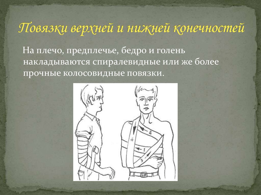 Повязки верхней и нижней конечностей