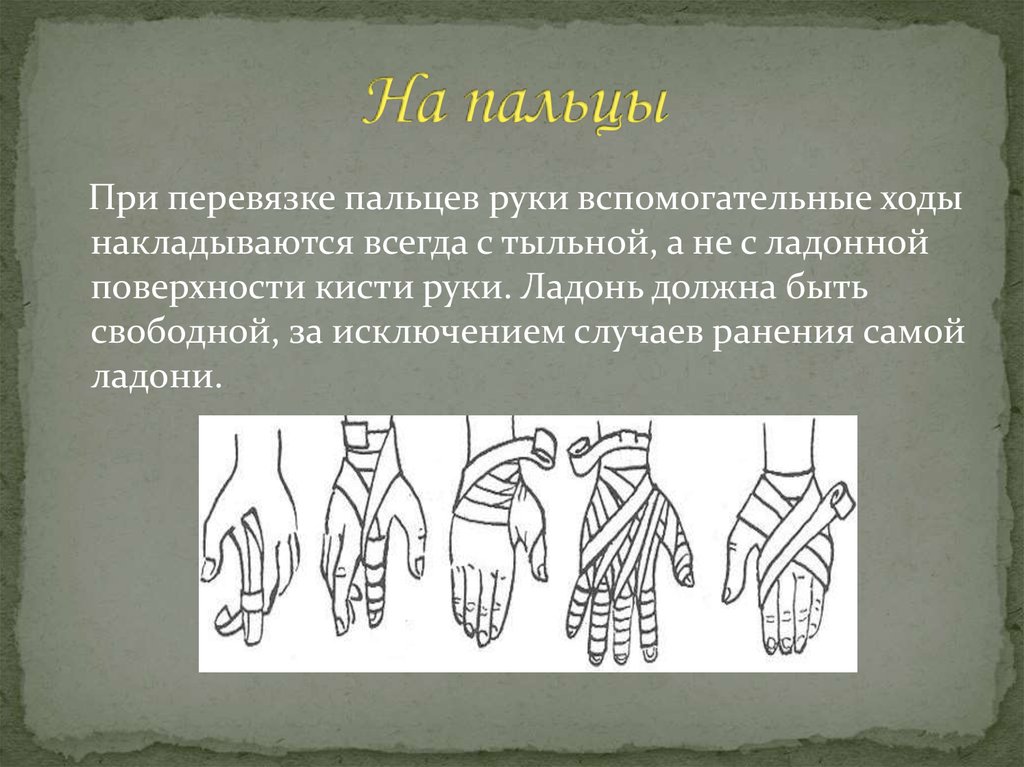 Звук перевязки. Виды перевязок на руку. Перевязка пальцев. Перевязка руки. Повязка на тыльную поверхность кисти.