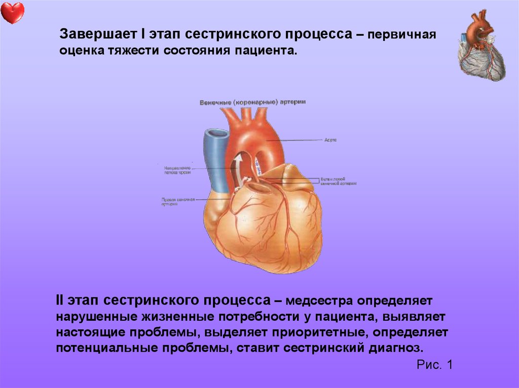 Стенокардия презентация казакша