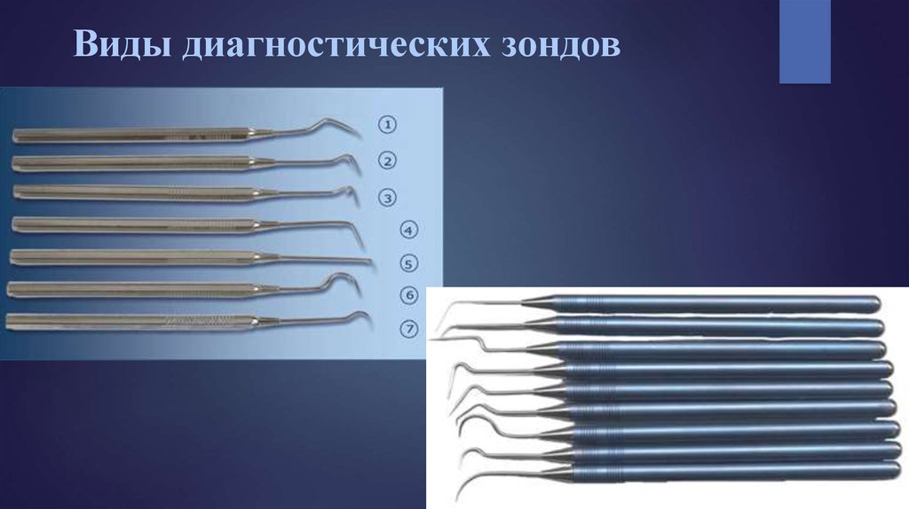 Виды зондов стоматология Лечение периостита Томск Развития