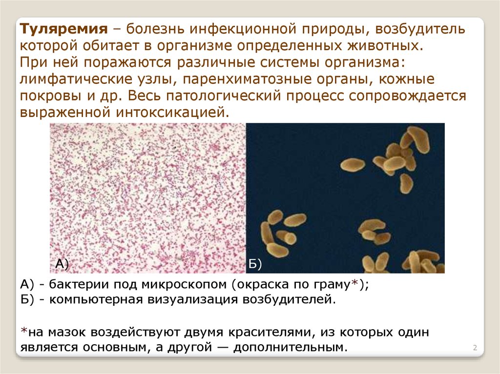 Туляремия презентация инфекционные болезни