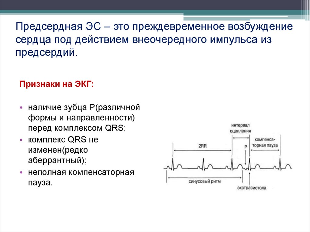 Нарушения проводимости клинические рекомендации. Возбуждение сердца. Результирующий вектор возбуждения предсердий. Особенности возбудимости сердца экстрасистола. Узловой ритм с преждевременным возбуждением предсердий.