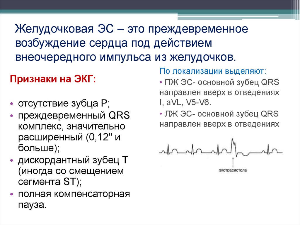 Возбуждение сердца. Синдром преждевременного возбуждения желудочков на ЭКГ. Парциальный синдром предвозбуждения желудочков на ЭКГ. ЭКГ критерии синдрома преждевременного возбуждения желудочков. Преждевременное возбуждение желудочков на ЭКГ.