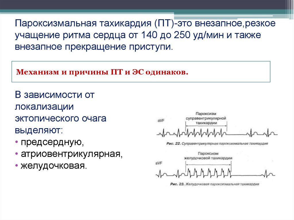 Пароксизмальная тахикардия это