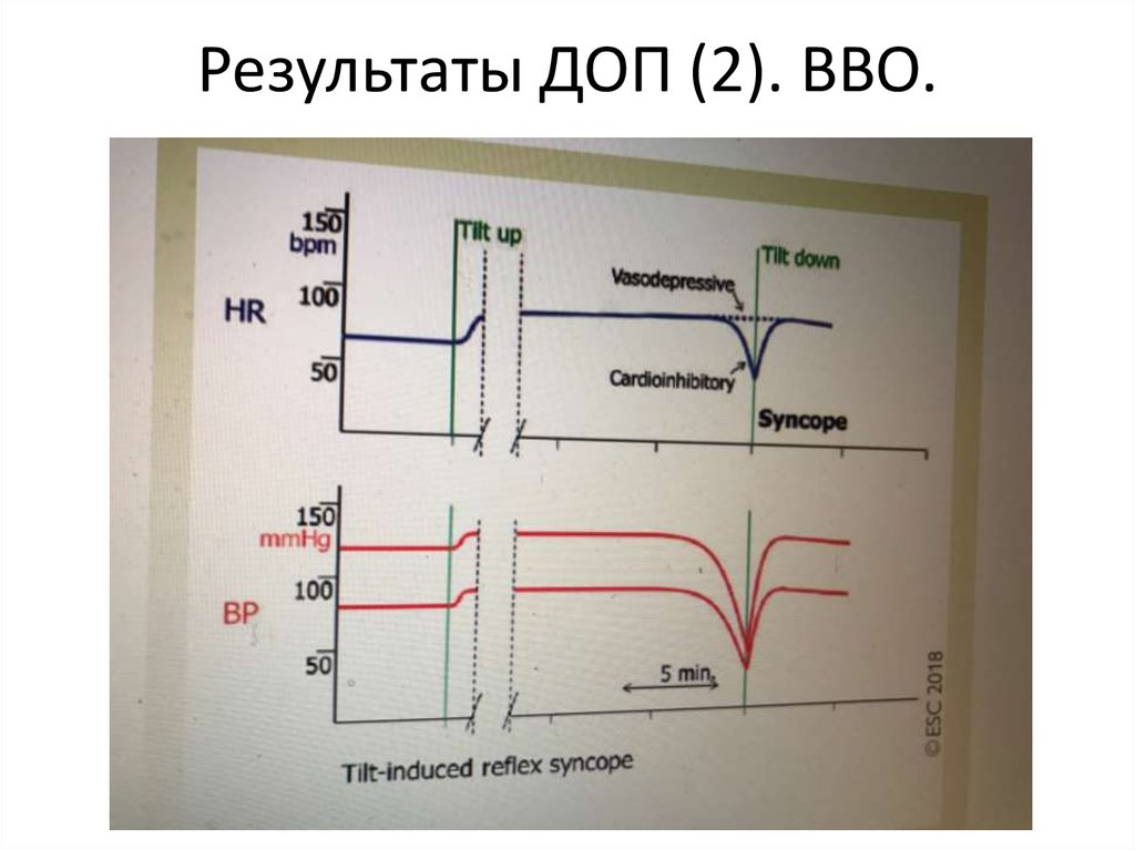 2 дополнительных. Результаты ВВО.