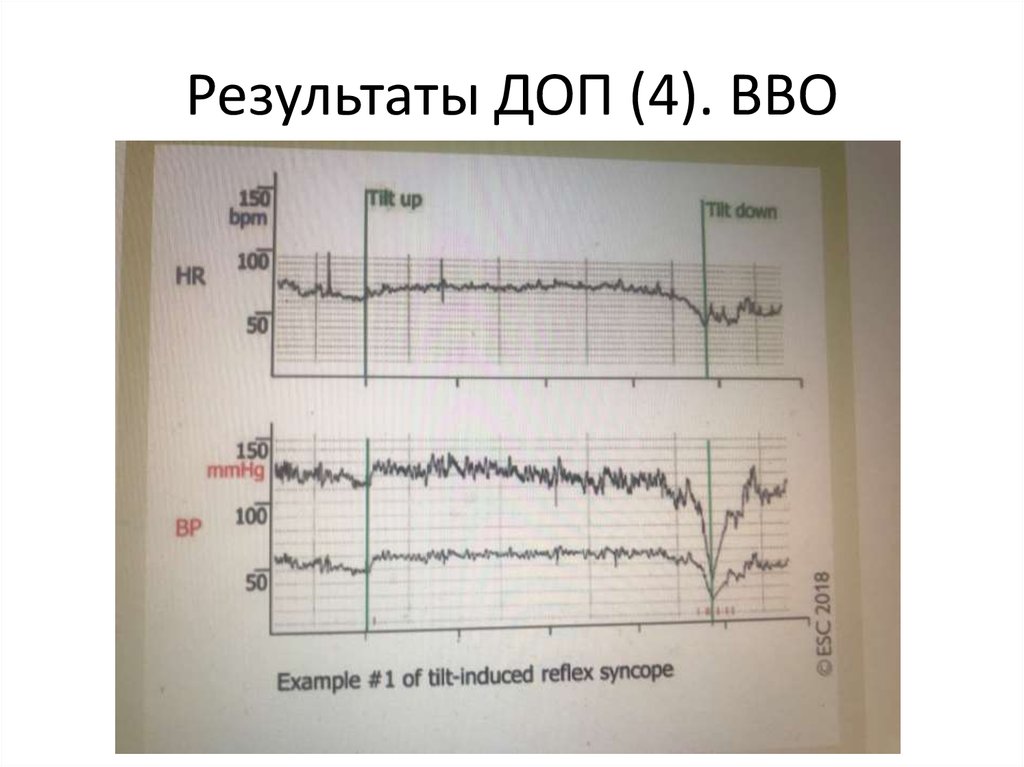 Результаты доп. Результаты вво.