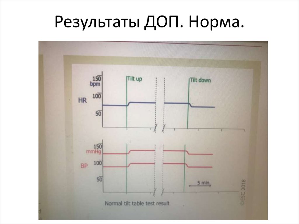 Дополнительные результаты