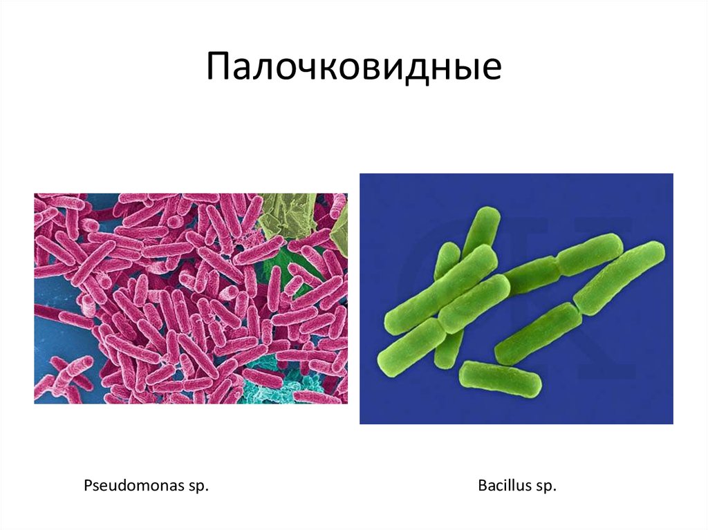 Палочковидные. Палочковидные бактерии бациллы. Палочковидные бактерии микробиология бациллы. Бациллы микробиология морфология. Псевдомонады микробиология морфология.