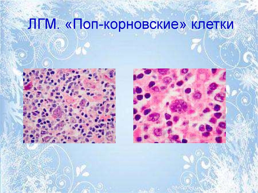 Опухоли меланинобразующей ткани презентация