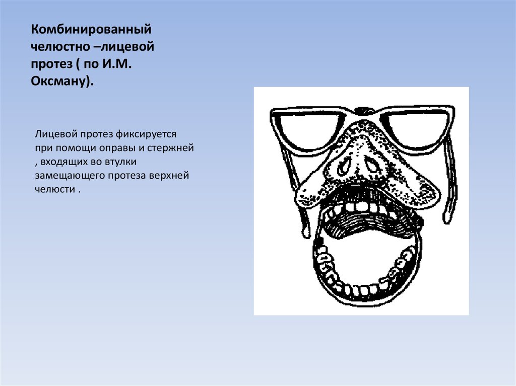 Схема классификация повреждений челюстно лицевой области