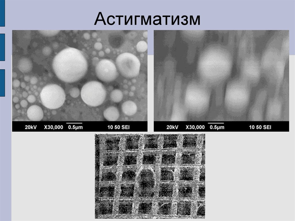 Астигматизм