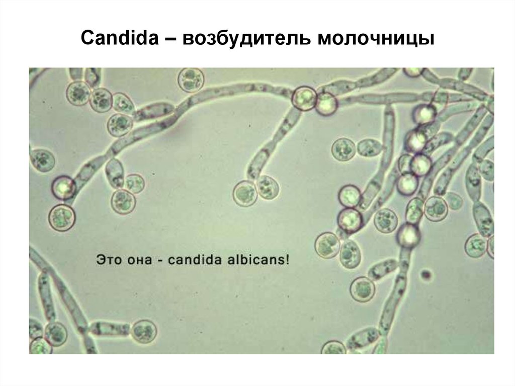 Молочница бактерии. Дрожжеподобные грибы кандида микробиология. Грибы кандида микроскопия. Биопленка Candida albicans. Грибы рода кандида под микроскопом.