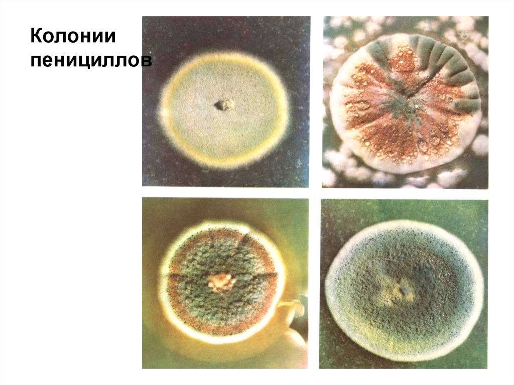 Колонии пеницилла. Колония гриба пеницилла. Пеницилл внешний вид колонии. Битоксибациллин под микроскопом.