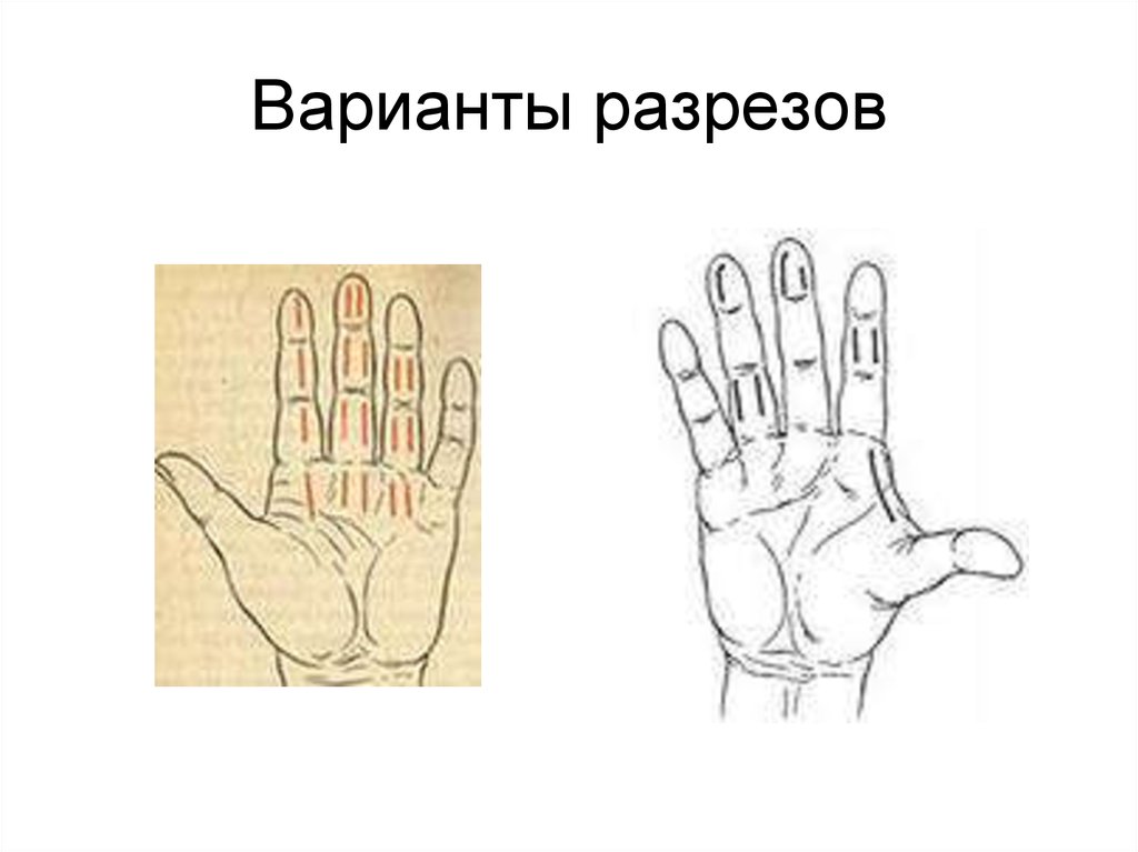 Варианты разрезов