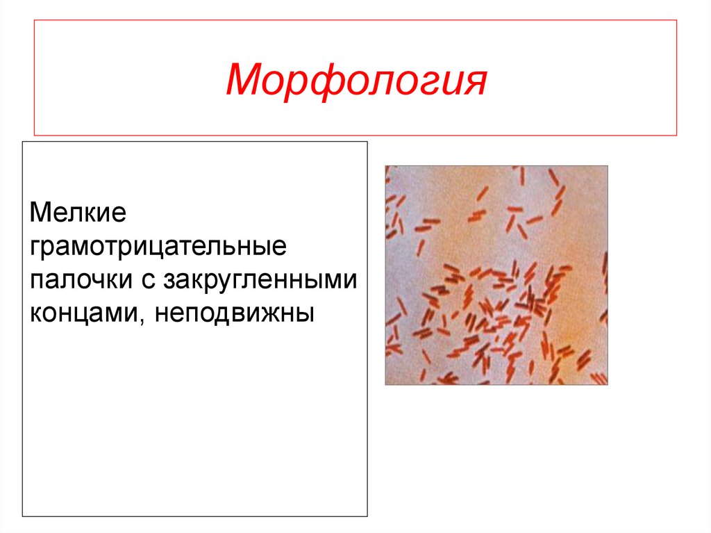 Возбудитель дизентерии. Дизентерия морфология. Грамотрицательные палочки возбудители. Шигелла дизентерия морфология. Шигеллы энтеробактерии морфология.