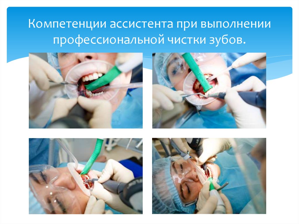 Компетенции ассистента при выполнении профессиональной чистки зубов.