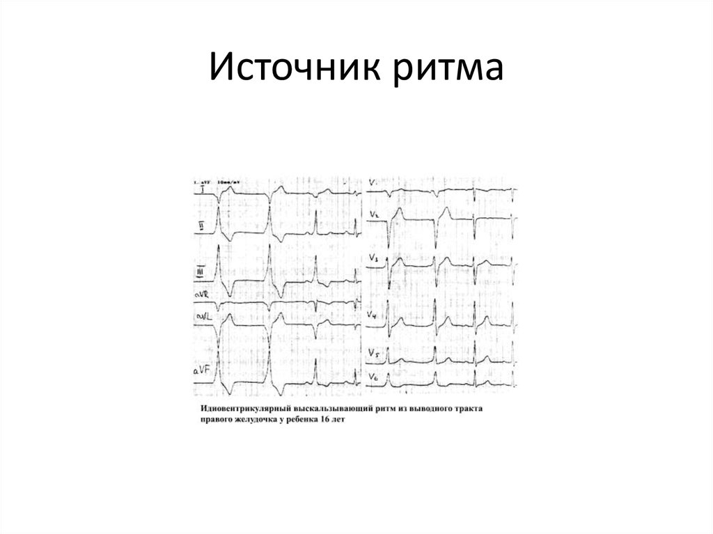 Источник ритма