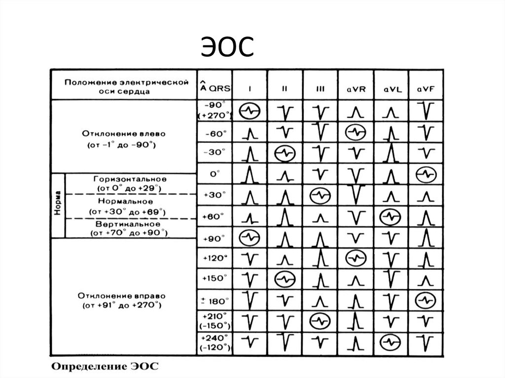 Эос экг картинки