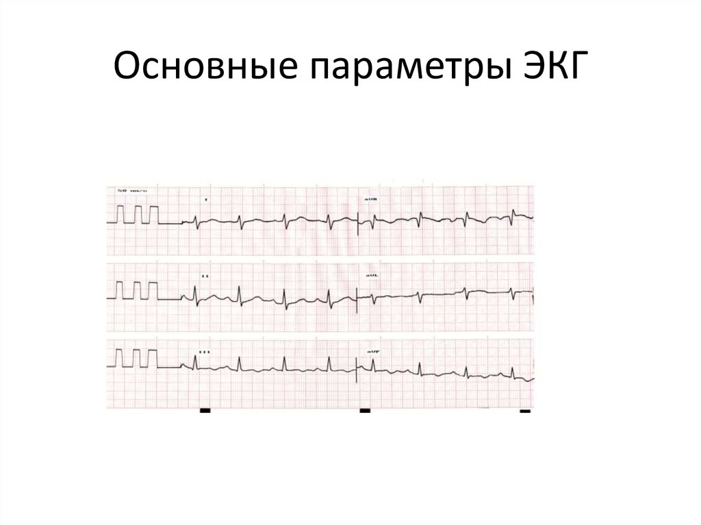 Экг диагностика. Параметры ЭКГ. Основные временные параметры ЭКГ. Основное параметры ЭКГ. ЭКГ диагностика Ким.