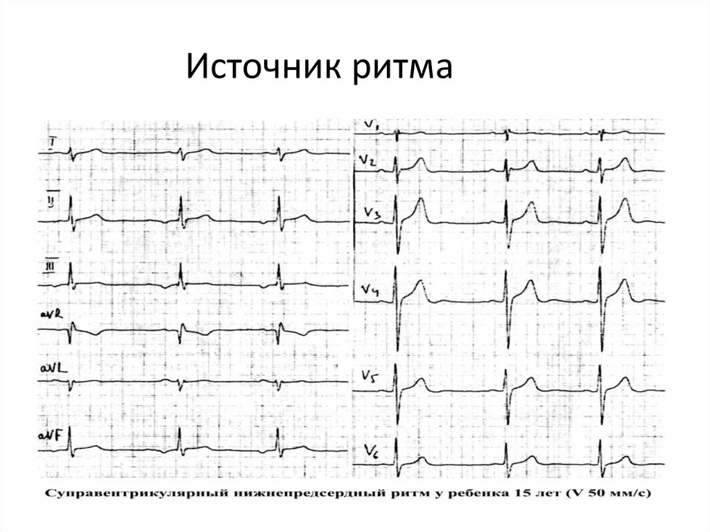 Источник ритма