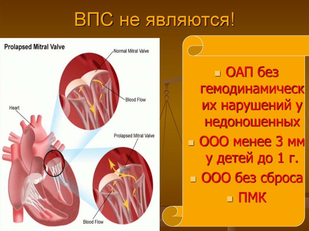 Врожденные пороки сердца презентация по педиатрии