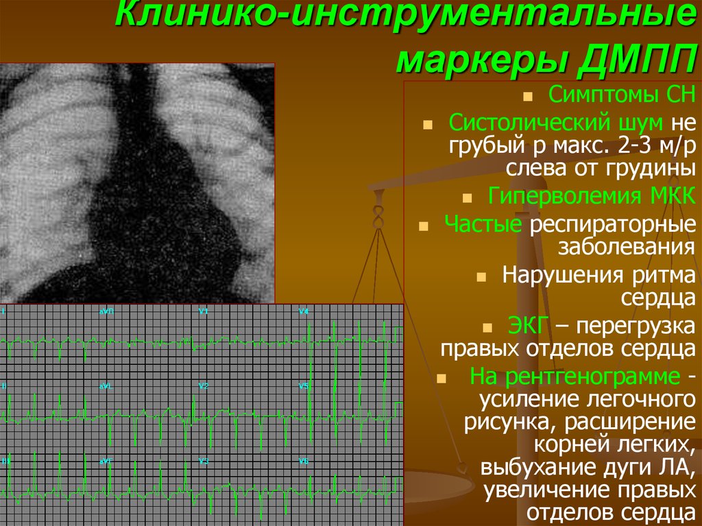 Квантовый шум презентация