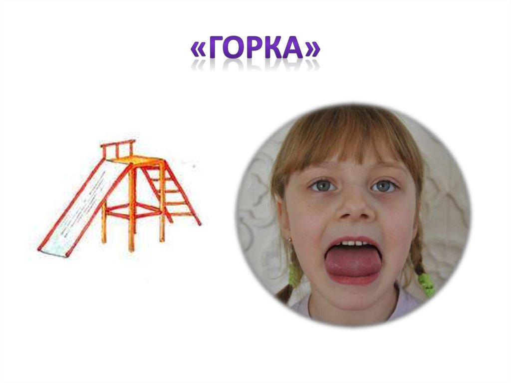 «горка»