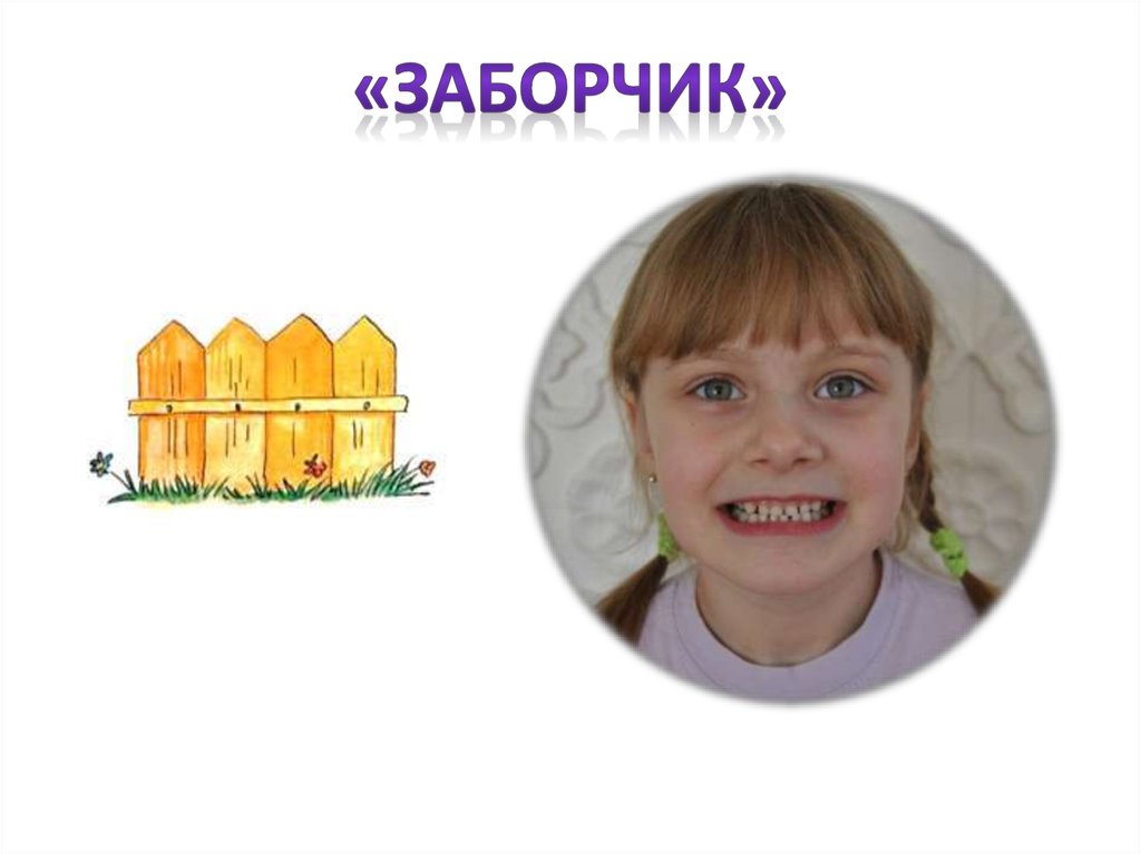 «Заборчик»