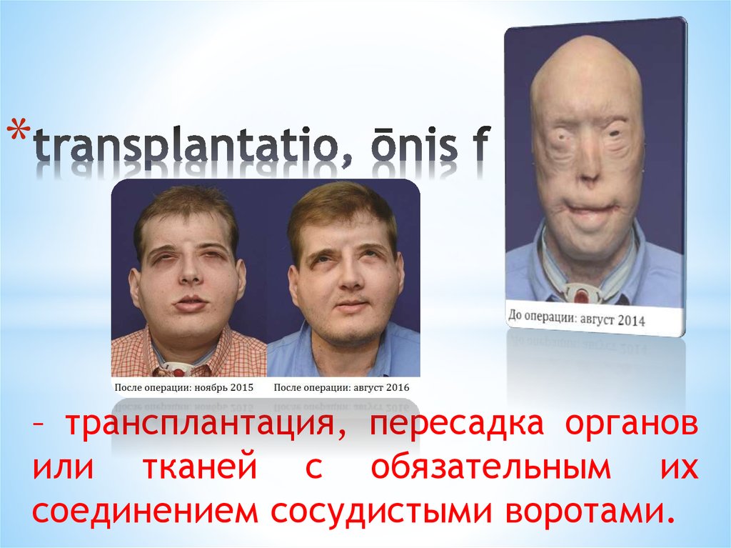 transplantatio, ōnis f