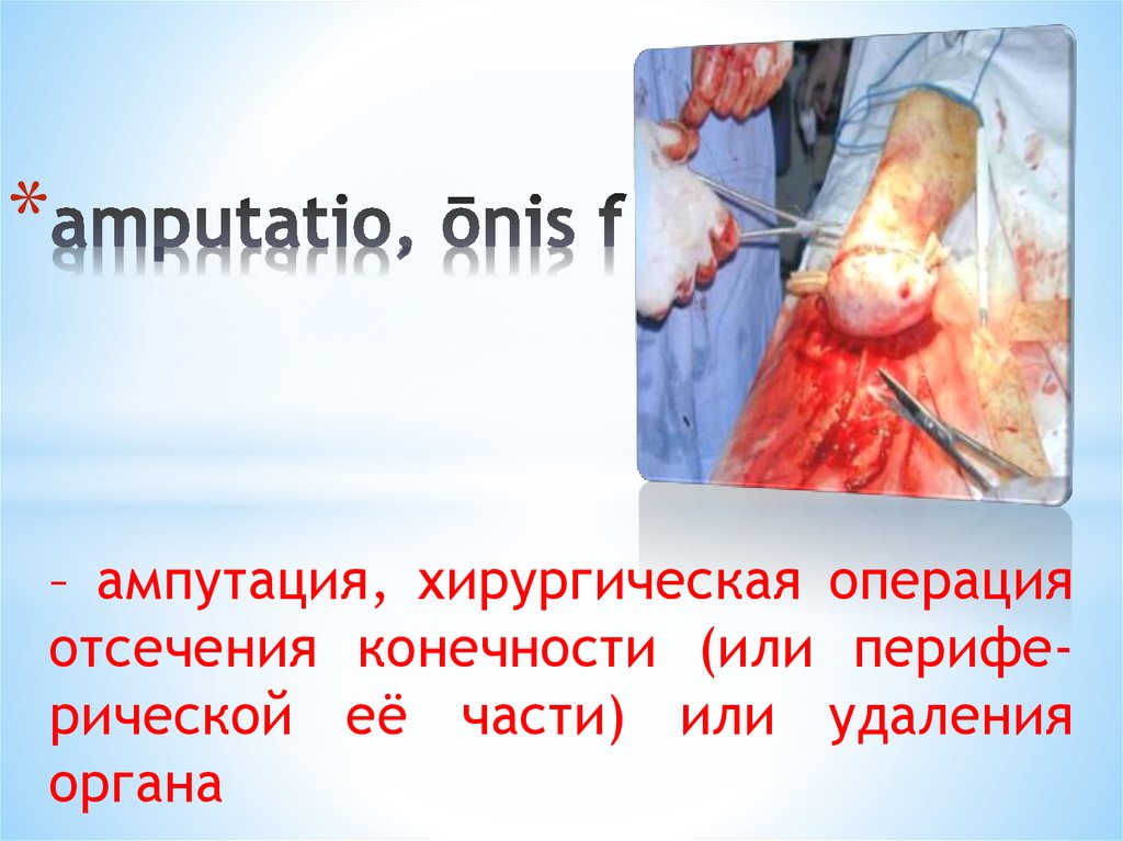 amputatio, ōnis f