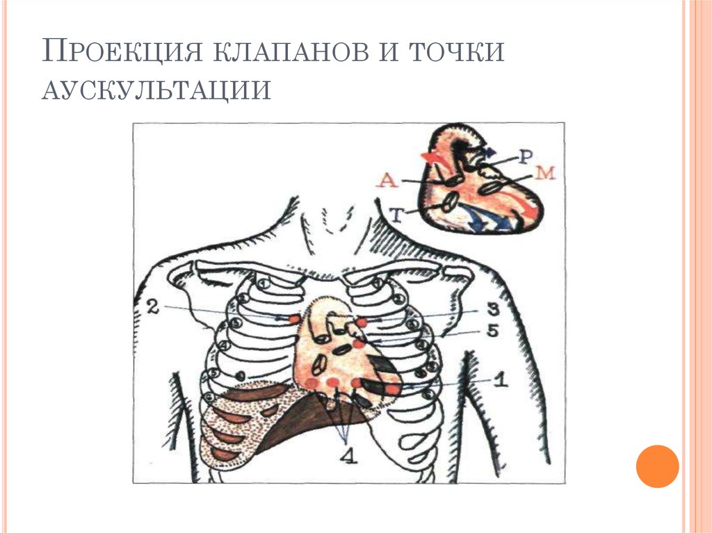 Точки аускультации сердца