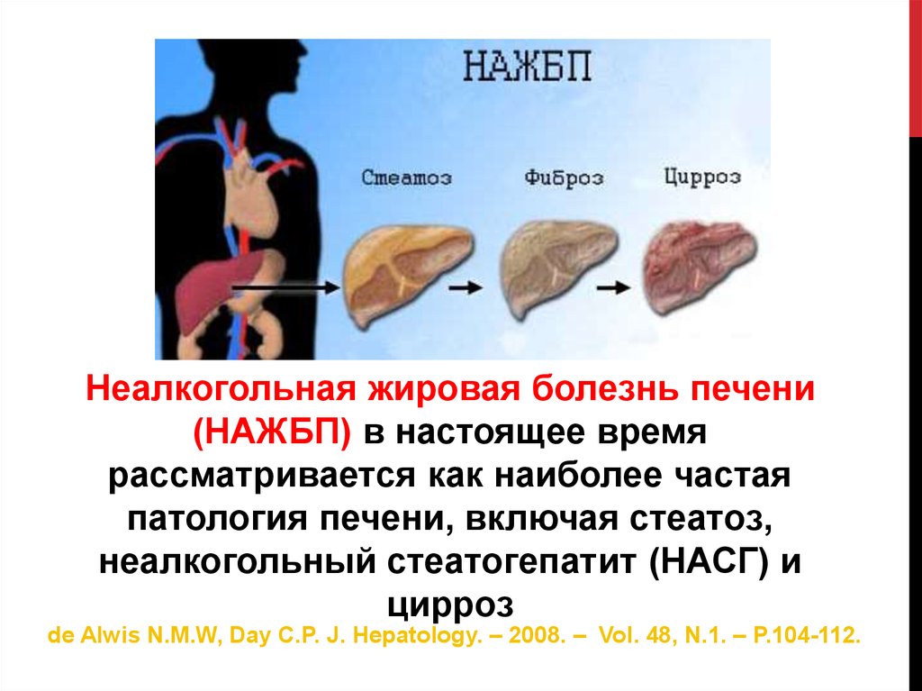 Температура при заболевании печени