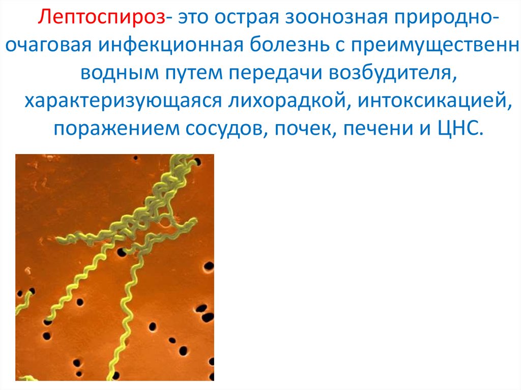 Лептоспироз презентация инфекционные болезни