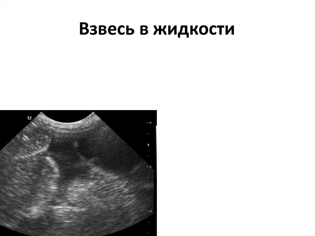 Взвесь в жидкости