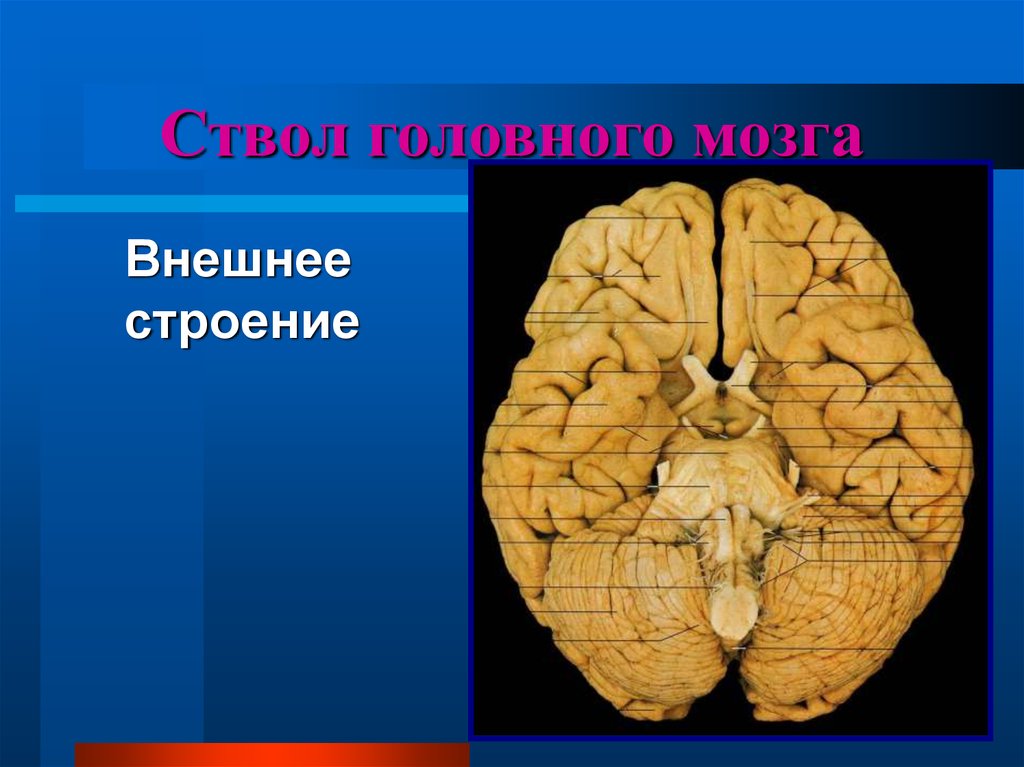 Внешний мозг. Ствол мозга. Столб головного мозга. Ствол головного мозга препарат. Ствол головного мозга препарат анатомия.