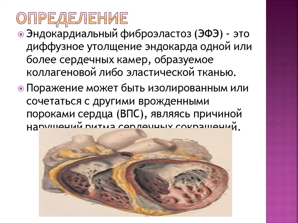 Определение