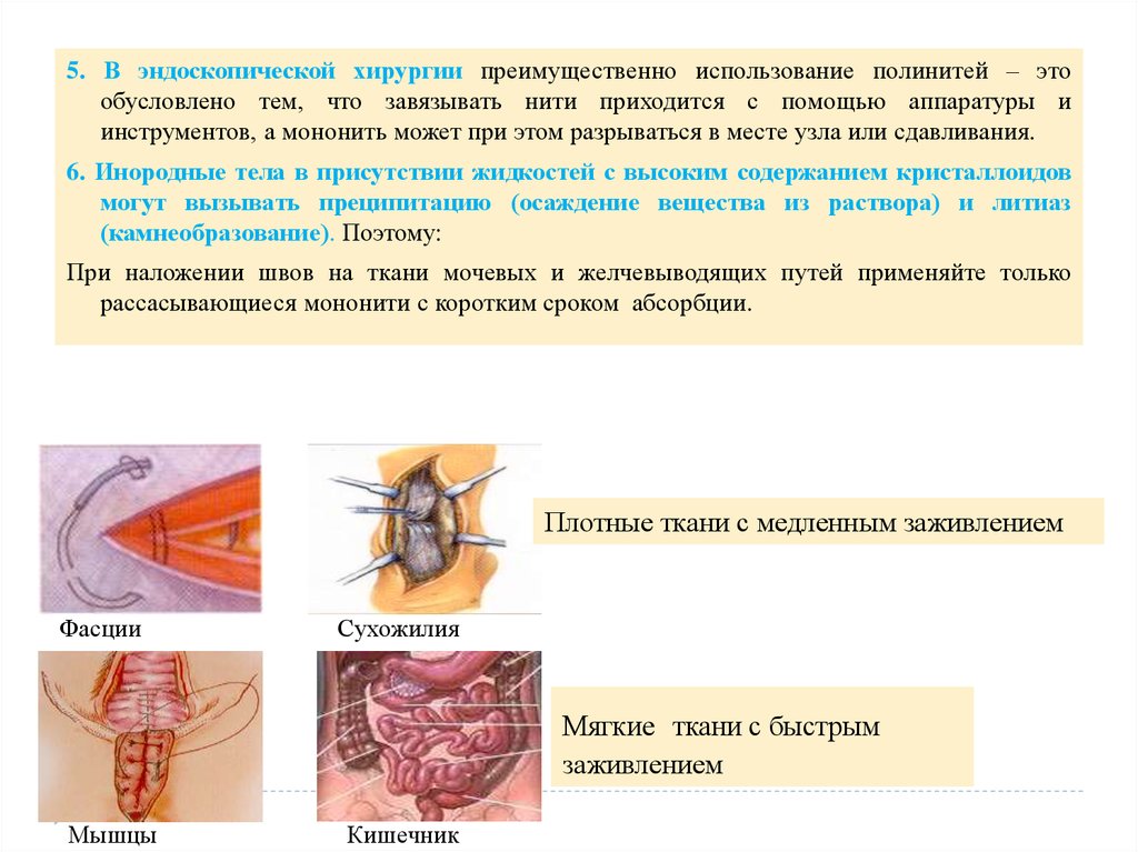 Хирургические швы презентация