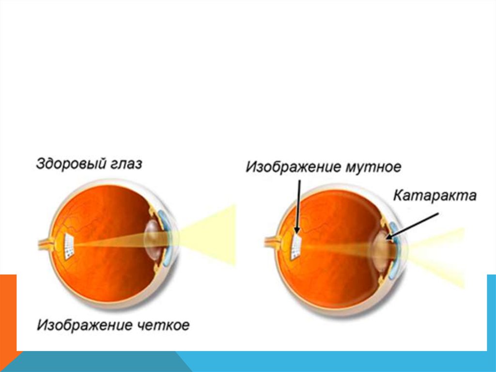 Почему в зеркальном фотоаппарате мутное изображение