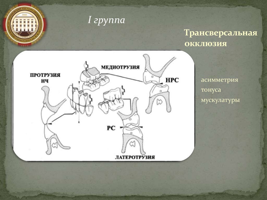 Трансверсальная окклюзия