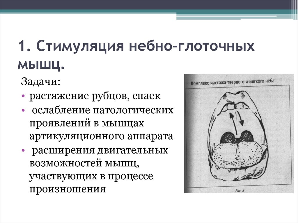 Схема взаимосвязи звуков при ринолалии