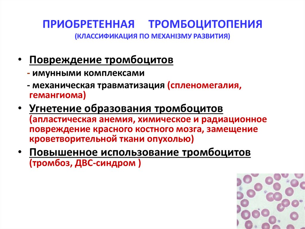 Тромбоцитопения это. Гипопластическая тромбоцитопения. Лимфопения тромбоцитопения. Тромбоцитопения и тромбоцитопатия. Асимптоматическая тромбоцитопения.