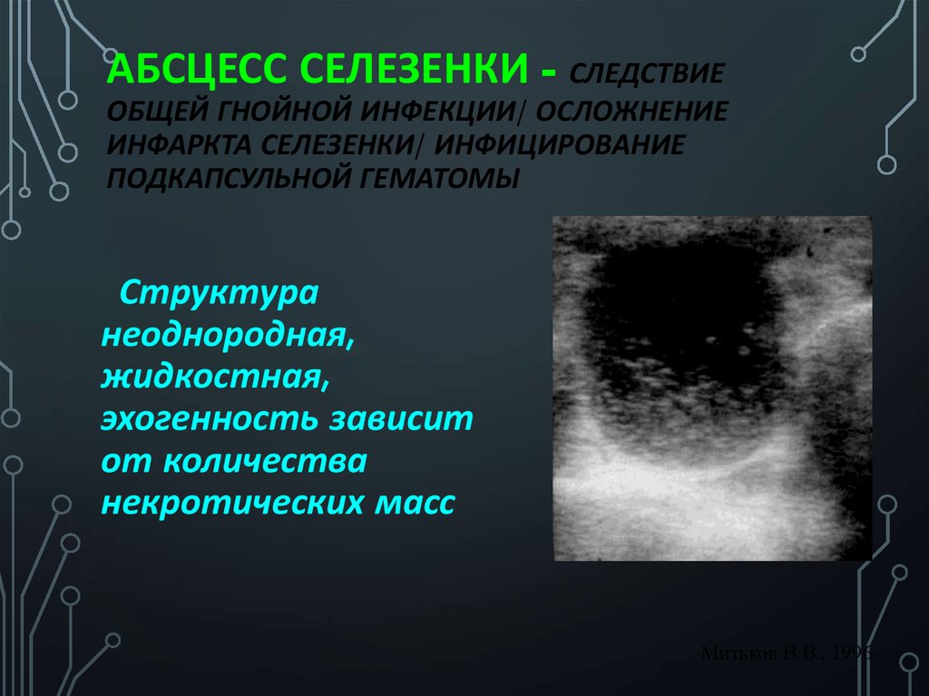 Заболевания селезенки презентация