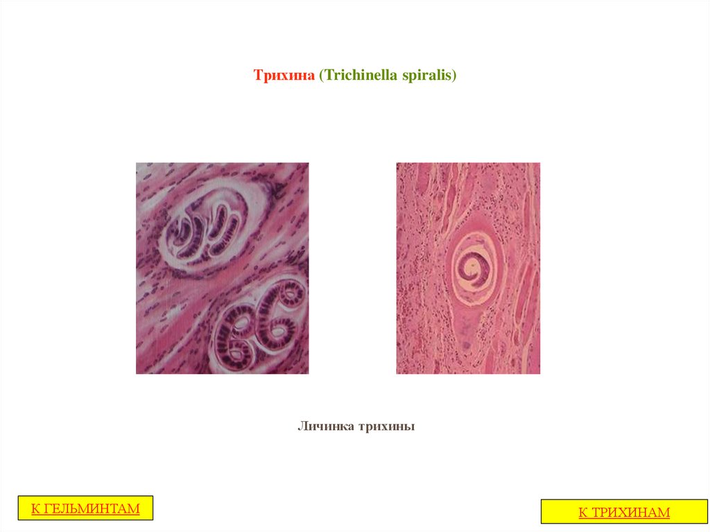 Личинки трихинеллы. Инкапсулированная личинка трихинеллы строение. Трихинелла (Trichinella spiralis). Инкапсулированные личинки трихинеллы в мышечной ткани. Trichinella spiralis инкапсулированная личинка.
